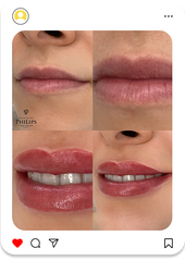 Collage + RETOUCH Type 17