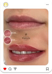 Collage + RETOUCH Type 19