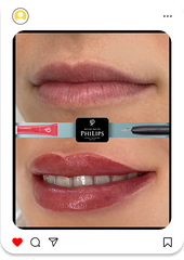 Collage + RETOUCH Type 10