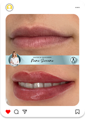 Collage + RETOUCH Type 15